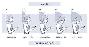 How Your Phone Is Wrecking Your Posture—and What to Do About It