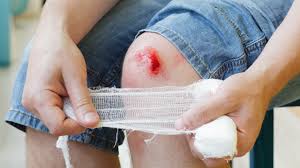 How to Heal Faster After an Injury – Backed by Science